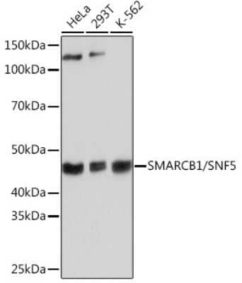 Western Blot: SNF5 Antibody (9A9G0) [NBP3-16159]