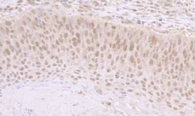 Immunohistochemistry: SNF5 Antibody [NB100-57525]