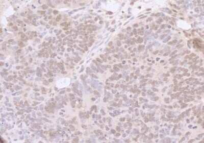 Immunohistochemistry: SNF5 Antibody [NB100-57525]