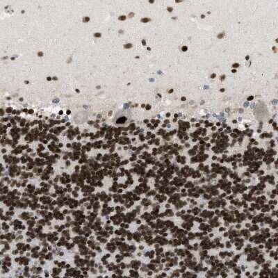 Immunohistochemistry-Paraffin: SNF5 Antibody [NBP1-90013]