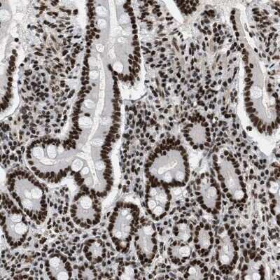 Immunohistochemistry-Paraffin: SNF5 Antibody [NBP1-90013]