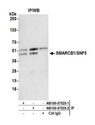 Immunoprecipitation: SNF5 Antibody [NB100-57525]