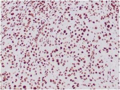 Immunohistochemistry-Paraffin: SNF5 Antibody (SMARCB1/3984) [NBP3-13774]