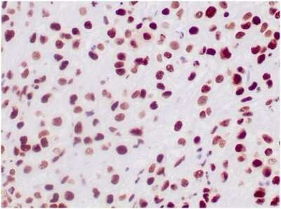 Immunohistochemistry-Paraffin: SNF5 Antibody (SMARCB1/3984) [NBP3-13774]