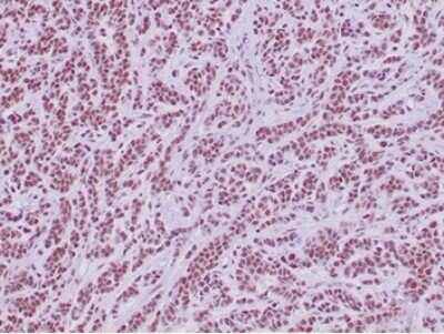 Immunohistochemistry-Paraffin: SNF5 Antibody (SMARCB1/4587R) [NBP3-13776]