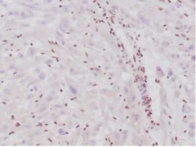 Immunohistochemistry-Paraffin: SNF5 Antibody (SMARCB1/4587R) [NBP3-13776]