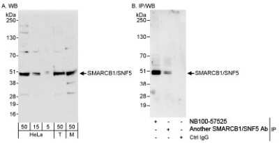 Western Blot: SNF5 Antibody [NB100-57525]