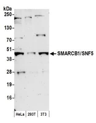 Western Blot: SNF5 Antibody [NB100-57525]