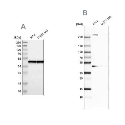 Western Blot: SNF5 Antibody [NBP1-90013]