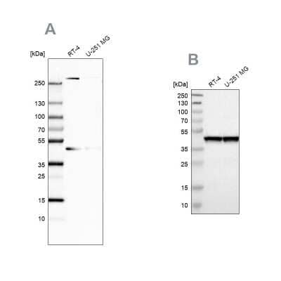 Western Blot: SNF5 Antibody [NBP1-90014]