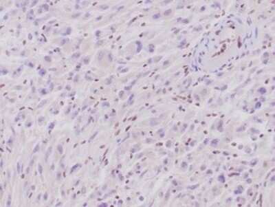 Immunohistochemistry-Paraffin: SNF5 Antibody (rSMARCB1/4588) [NBP3-13775]