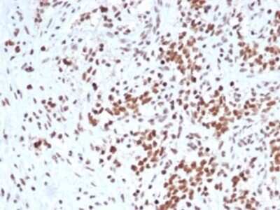 Immunohistochemistry-Paraffin: SNF5 Antibody (rSMARCB1/4588) [NBP3-13775]