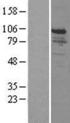 Western Blot: SNF5 Overexpression Lysate [NBP2-04243]