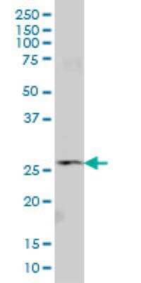 Western Blot: SNF8 Antibody (6B11) [H00011267-M01]
