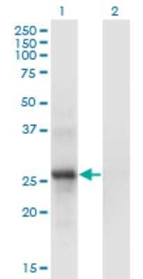 Western Blot: SNF8 Antibody (6B11) [H00011267-M01]