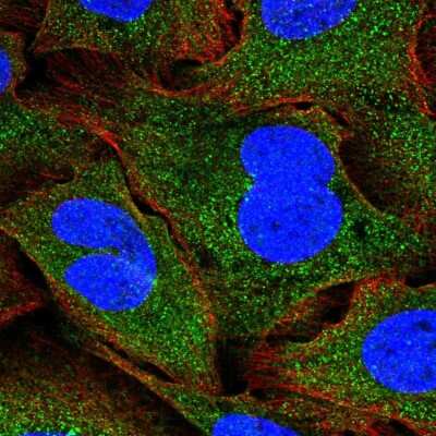 Immunocytochemistry/ Immunofluorescence: SNF8 Antibody [NBP2-32449]