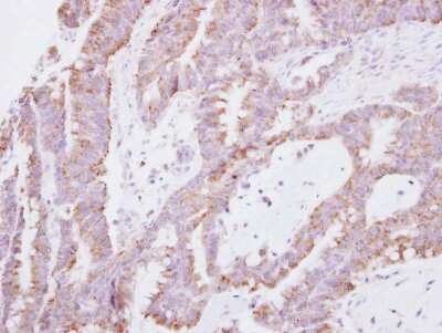Immunohistochemistry-Paraffin: SNF8 Antibody [NBP2-15125]
