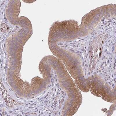 Immunohistochemistry-Paraffin: SNF8 Antibody [NBP2-32449]