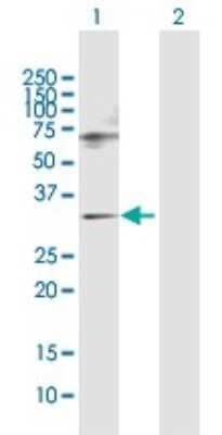 Western Blot: SNF8 Antibody [H00011267-D01P]