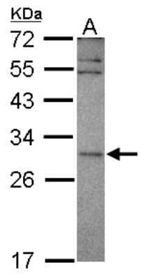 Western Blot: SNF8 Antibody [NBP2-15125]