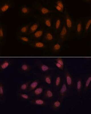 Immunocytochemistry/ Immunofluorescence: SNIP1 Antibody - Azide and BSA Free [NBP2-93789]