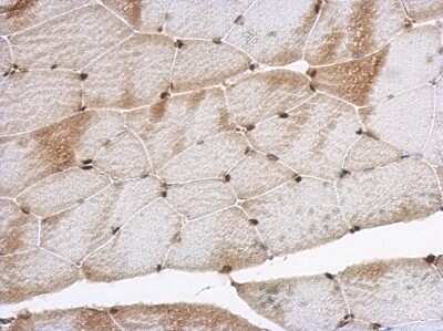 Immunohistochemistry-Paraffin: SNIP1 Antibody [NBP2-20437]