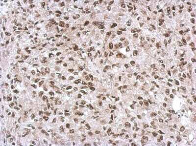 Immunohistochemistry-Paraffin: SNIP1 Antibody [NBP2-20437]