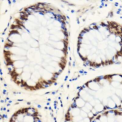 Immunohistochemistry-Paraffin: SNIP1 Antibody - Azide and BSA Free [NBP2-93789]