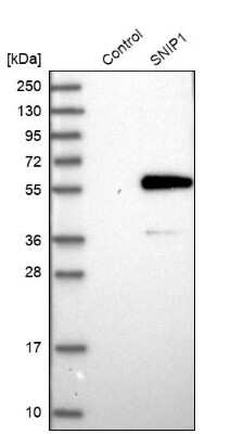 Western Blot: SNIP1 Antibody [NBP1-89428]