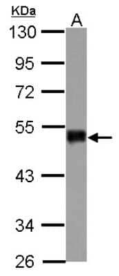 Western Blot: SNIP1 Antibody [NBP2-20437]