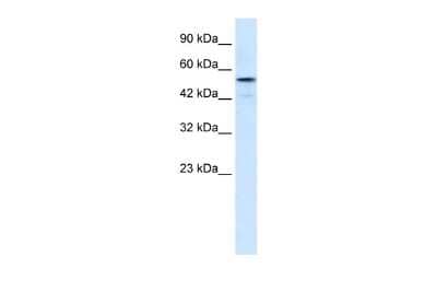 Western Blot: SNIP1 Antibody [NBP2-88322]