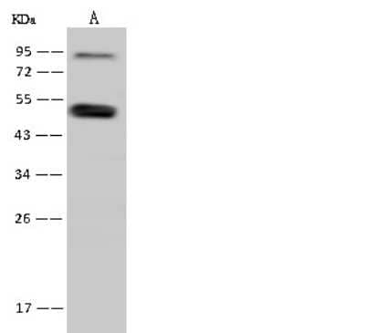 Western Blot: SNIP1 Antibody [NBP2-98468]