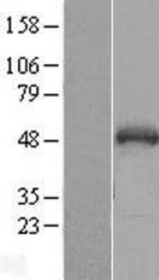 Western Blot: SNIP1 Overexpression Lysate [NBL1-16281]