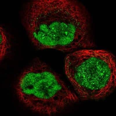 Immunocytochemistry: SNM1 Antibody [NBP1-89663]