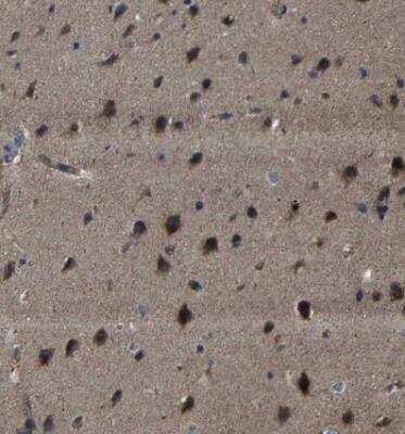 Immunohistochemistry-Paraffin: SNN Antibody [NBP1-91104]