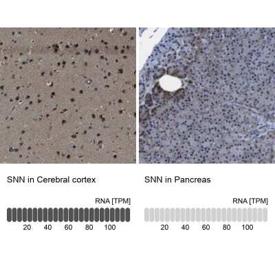 Immunohistochemistry-Paraffin: SNN Antibody [NBP1-91104]