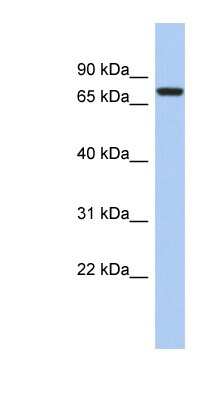 Western Blot: SNRK Antibody [NBP1-54944]