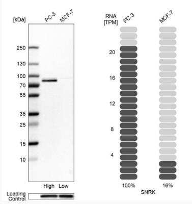 Western Blot: SNRK Antibody [NBP1-83668]