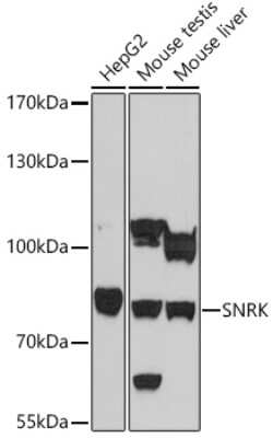 Western Blot: SNRK AntibodyAzide and BSA Free [NBP2-93104]