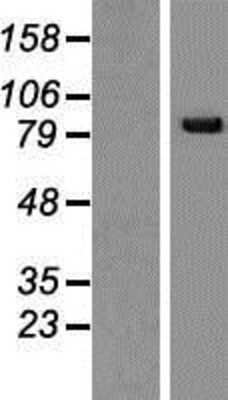 Western Blot: SNRK Overexpression Lysate [NBP2-06936]