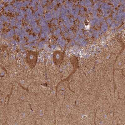 Immunohistochemistry-Paraffin: SNRNP25 Antibody [NBP2-32028]