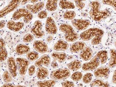 Immunohistochemistry-Paraffin: SNRNP25 Antibody [NBP3-06000]