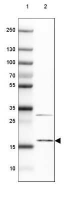 Western Blot: SNRNP25 Antibody [NBP2-32028]