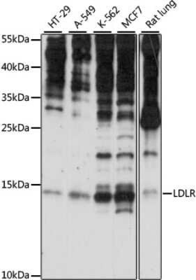 Western Blot: SNRNP25 AntibodyAzide and BSA Free [NBP2-93543]