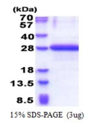 SDS-PAGE: Recombinant Human OBFC2A His Protein [NBP2-23299]