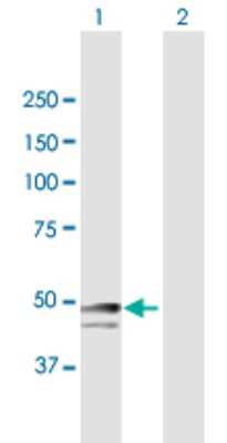 Western Blot: SNRNP48 Antibody [H00154007-B01P]