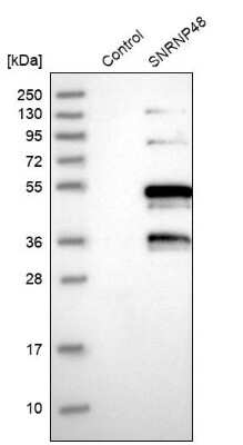 Western Blot: SNRNP48 Antibody [NBP1-86760]