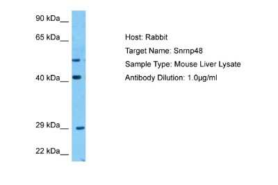 Western Blot: SNRNP48 Antibody [NBP2-85788]