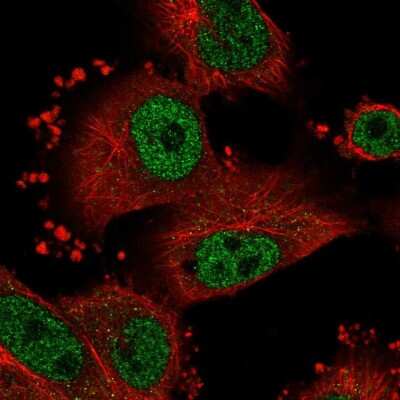 Immunocytochemistry/ Immunofluorescence: SNRP70 Antibody [NBP2-37905]