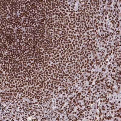 Immunohistochemistry-Paraffin: SNRP70 Antibody [NBP2-37896]